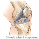 Knee joint