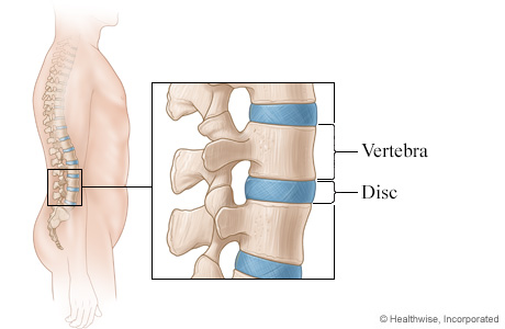 Picture of discs of the spine