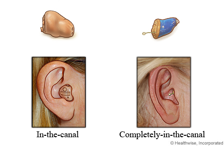 Styles of hearing aids