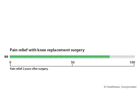 Out of 100 people who have knee replacement surgery, 80 have pain relief within 2 years after surgery.