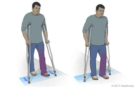 Walking with crutches
