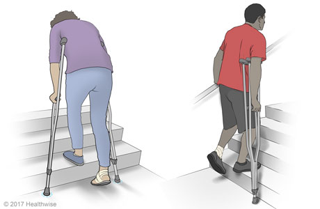 Walking up stairs with crutches