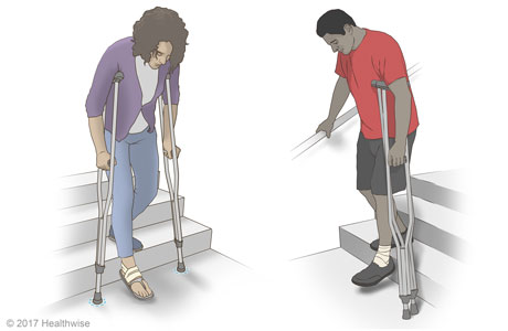 Walking down stairs with crutches