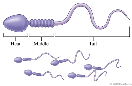  A group of sperm, with detail  of a single sperm 