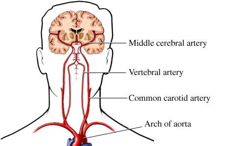 Blood supply to the brain