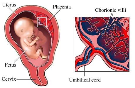 Picture of chorionic villi of the placenta