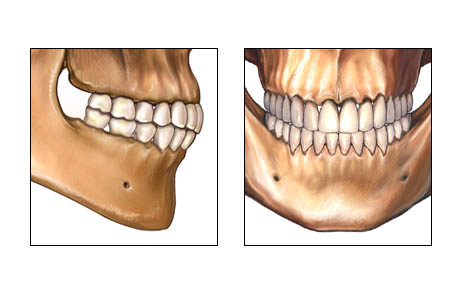 Occlusion